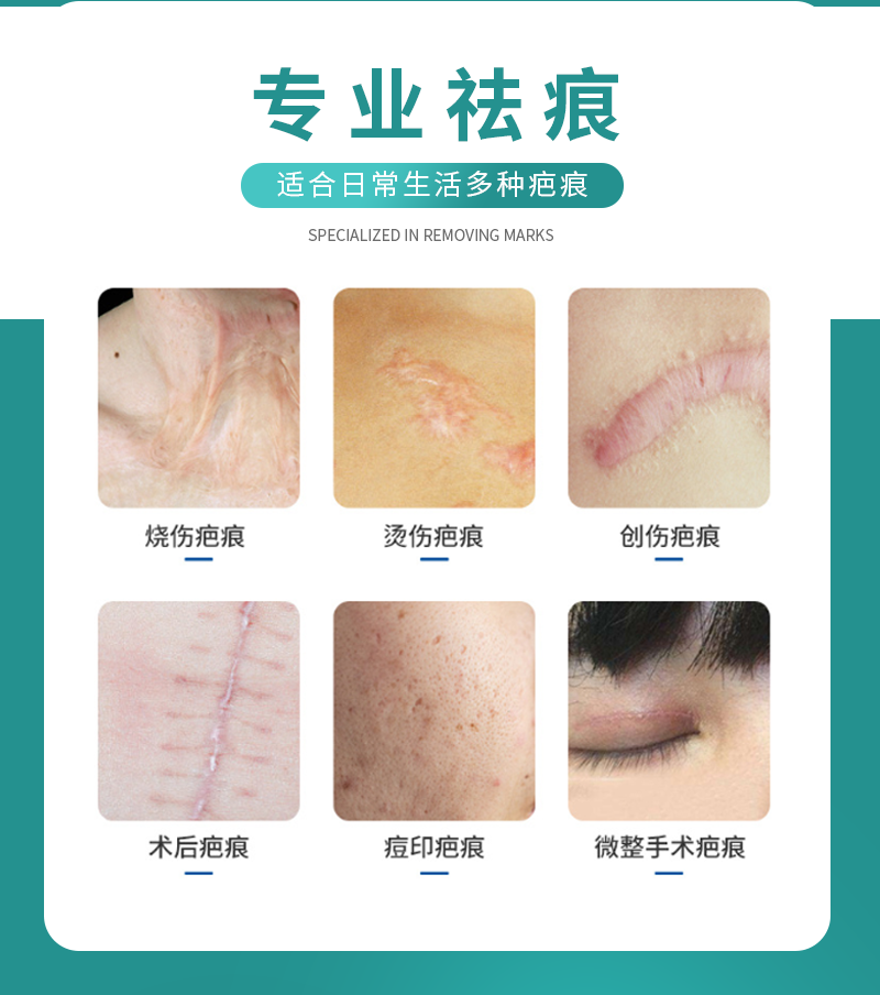 阿利美-医用疤痕凝胶-详情_02